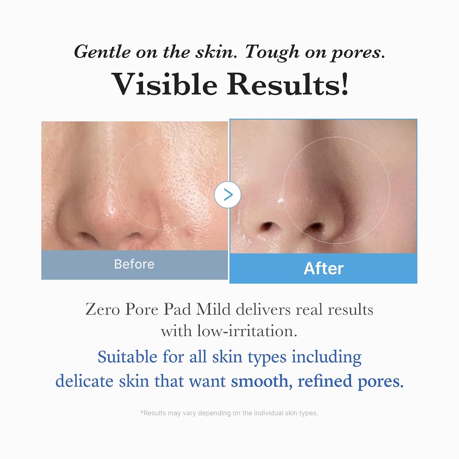 image:imagemedicube Toner Pads Deep Vita C Facial Toner Pad for Uneven Skin Tone amp Texture Vitamin Water and 3 Types of Vitamin Deeply Hydrating amp Resurfacing Pad Korean Skin Care 70 Pads 1 PackMild Pads