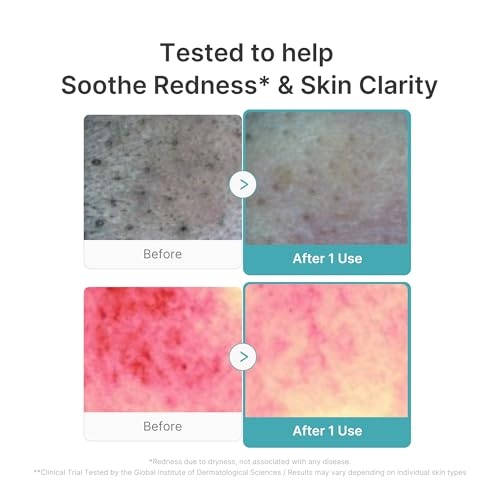 image:imagemedicube Azelaic Capsule Foam Cleanser and Pore Brush Set Deep Pore Cleansing for Fresh Clear and Smooth Skin Excess Sebum Care and Oil Control Korean Skincare