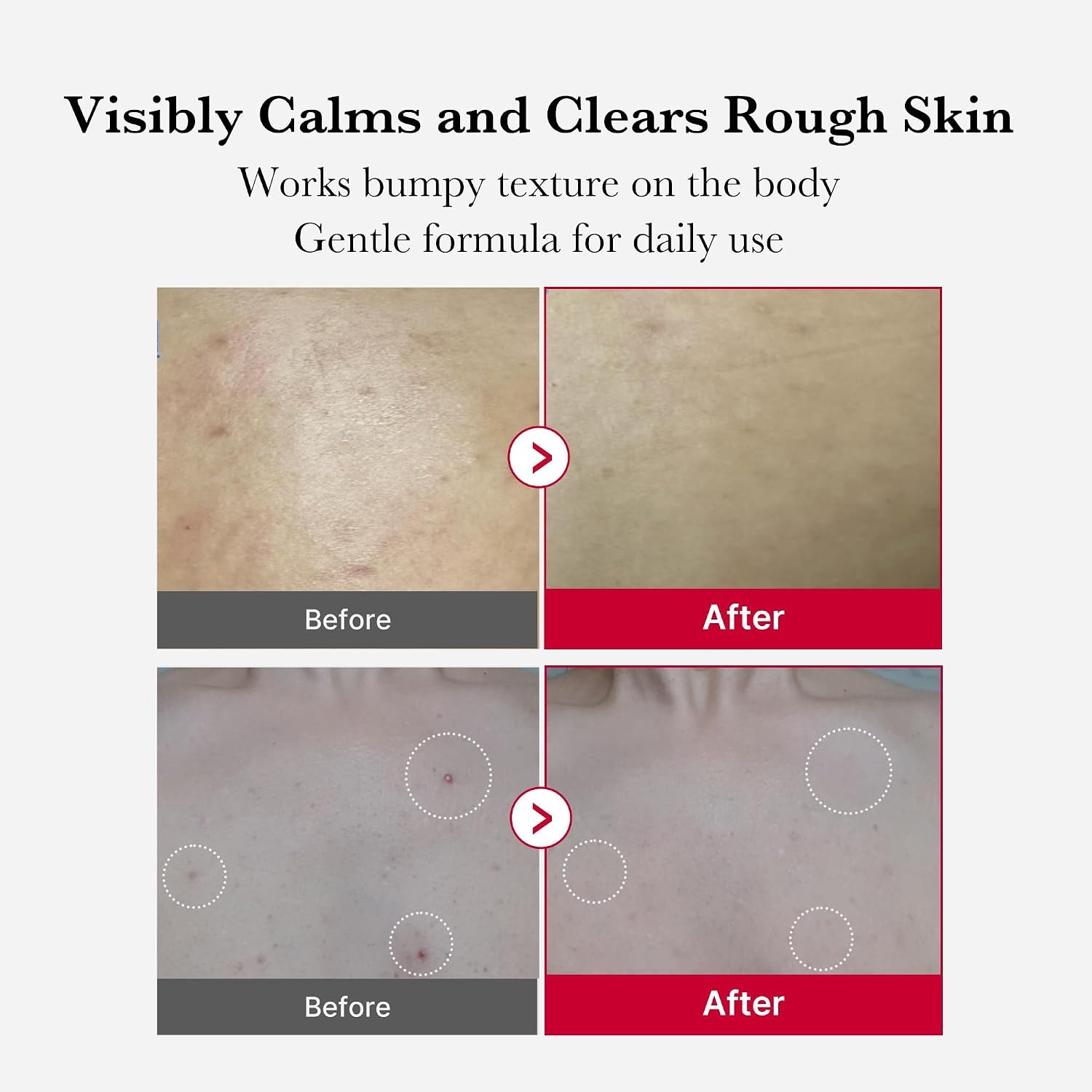 image:imagemedicube Ultimate Red Spray Duo to Smooth amp Soothe Power Soothing Spray and Red Body Peeling Shot