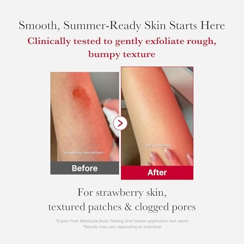 image:imagemedicube Ultimate Red Spray Duo to Smooth amp Soothe Power Soothing Spray and Red Body Peeling Shot
