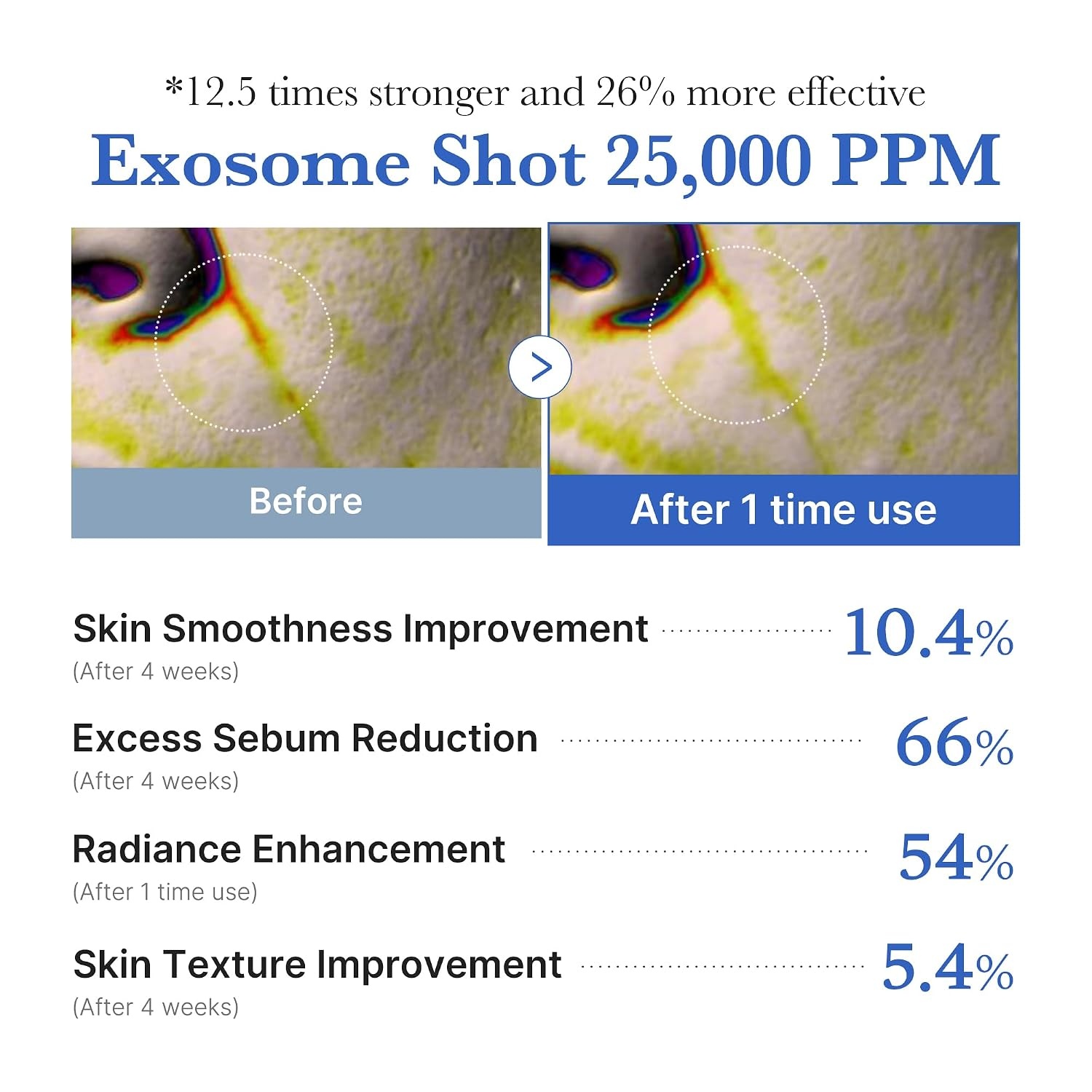 image:imagemedicube Exosome Shot Azelaic Acid 7500 PPM Spicule Facial Serum Pack of 2043 Fl Oz Pack of 2