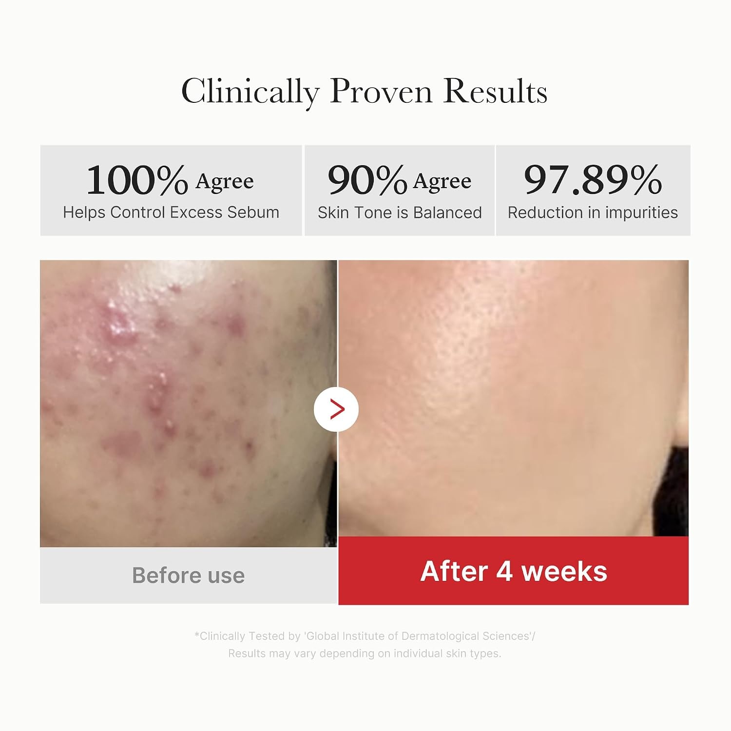 image:imagemedicube PDRN Cooling Soothing Toner Pads Hydrating Facial Pads 90 Pads Delivers cooling hydration and soothing care to leave skin looking smooth fresh and ready for makeup Korean SkincareRed Succinic Acid Pads