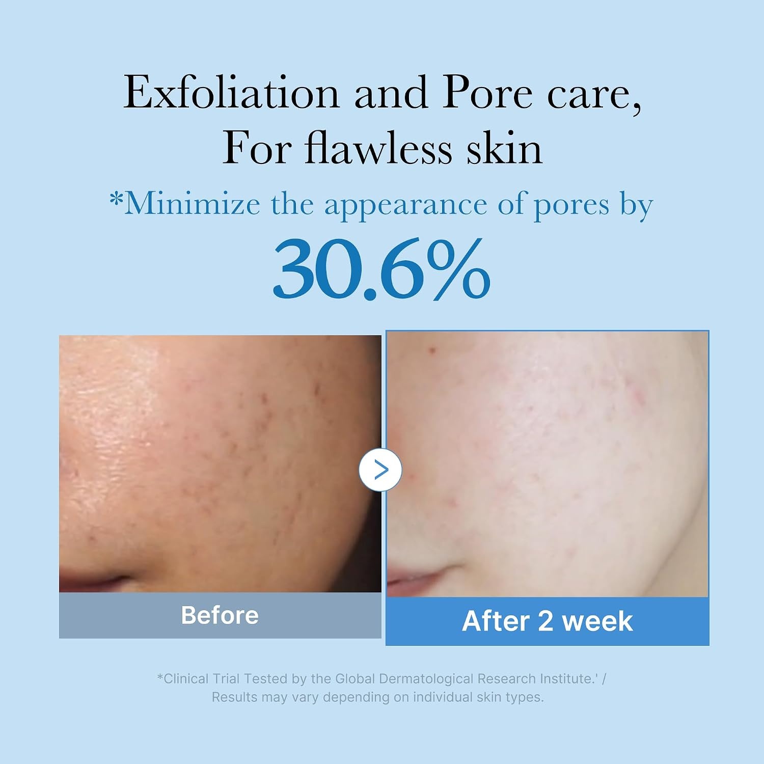 image:imagemedicube Zero Pore Exfoliating amp Hydrating Toner Pack of 2845 Fl Oz Pack of 1