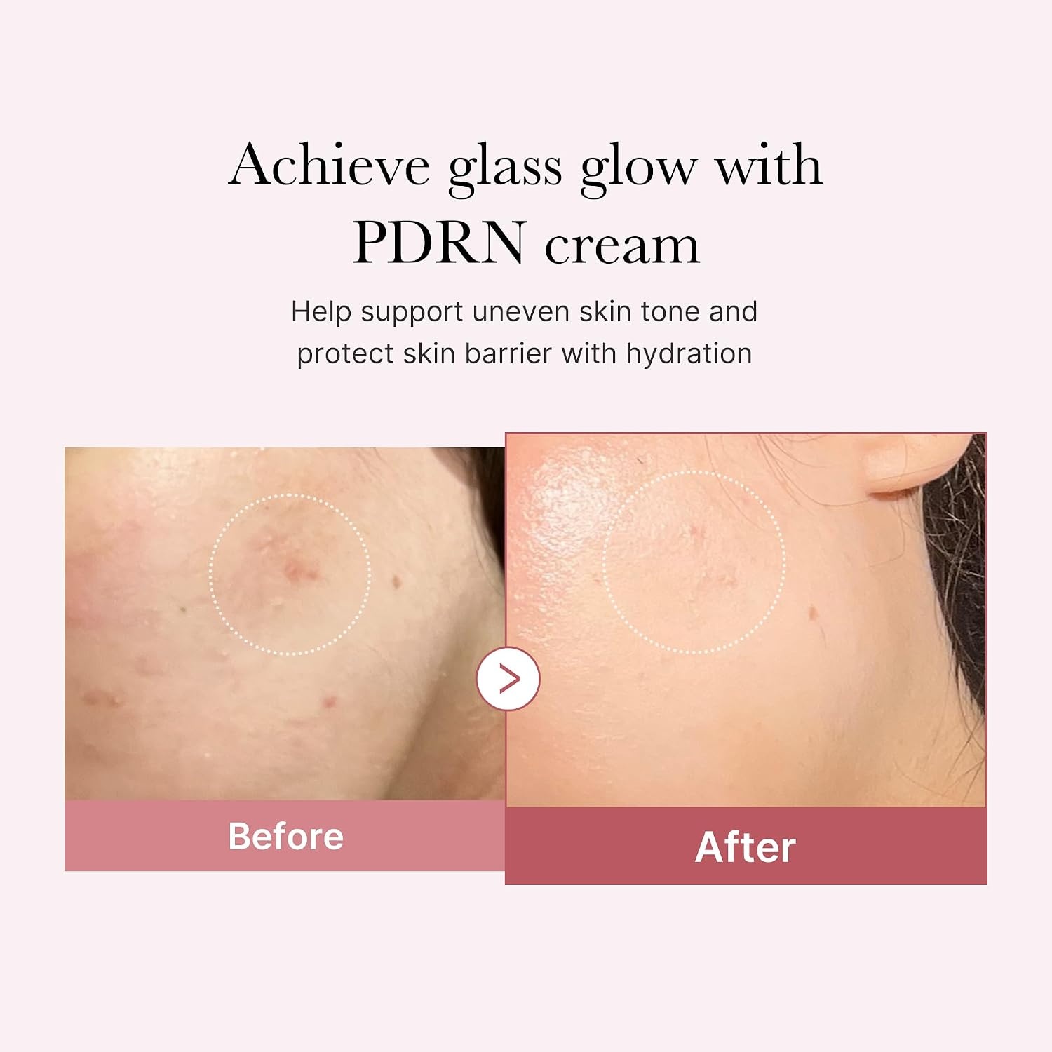 image:imagemedicube Rose PDRN Pink Hyaluronic Moisturizing Cream Blemish Relief Hydration amp Elasticity Care For the Look of Uneven Skin Tone amp Pores Korean Skincare 169 fl ozRose