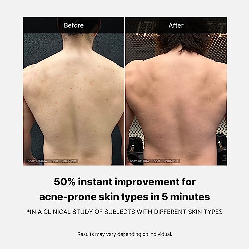 image:imagemedicube Red Body Wash 1410 Floz I Low pH and Hydrating Cleanser with Salicylic Acid Lactic Acid Niacinamide and Hyaluronic Acid Suitable for Bacne Treatment Korean Skin Care Pack of 4141 Ounce Pack of 4