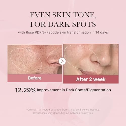 image:imagemedicube PDRN Toner Salmon DNA Milky Toner for Hydrating Moisturizing Soothing with Ceramide Peptide Glass Glow Skin Korean Skincare 507 floz Pack of 3Rose PDRN Watery