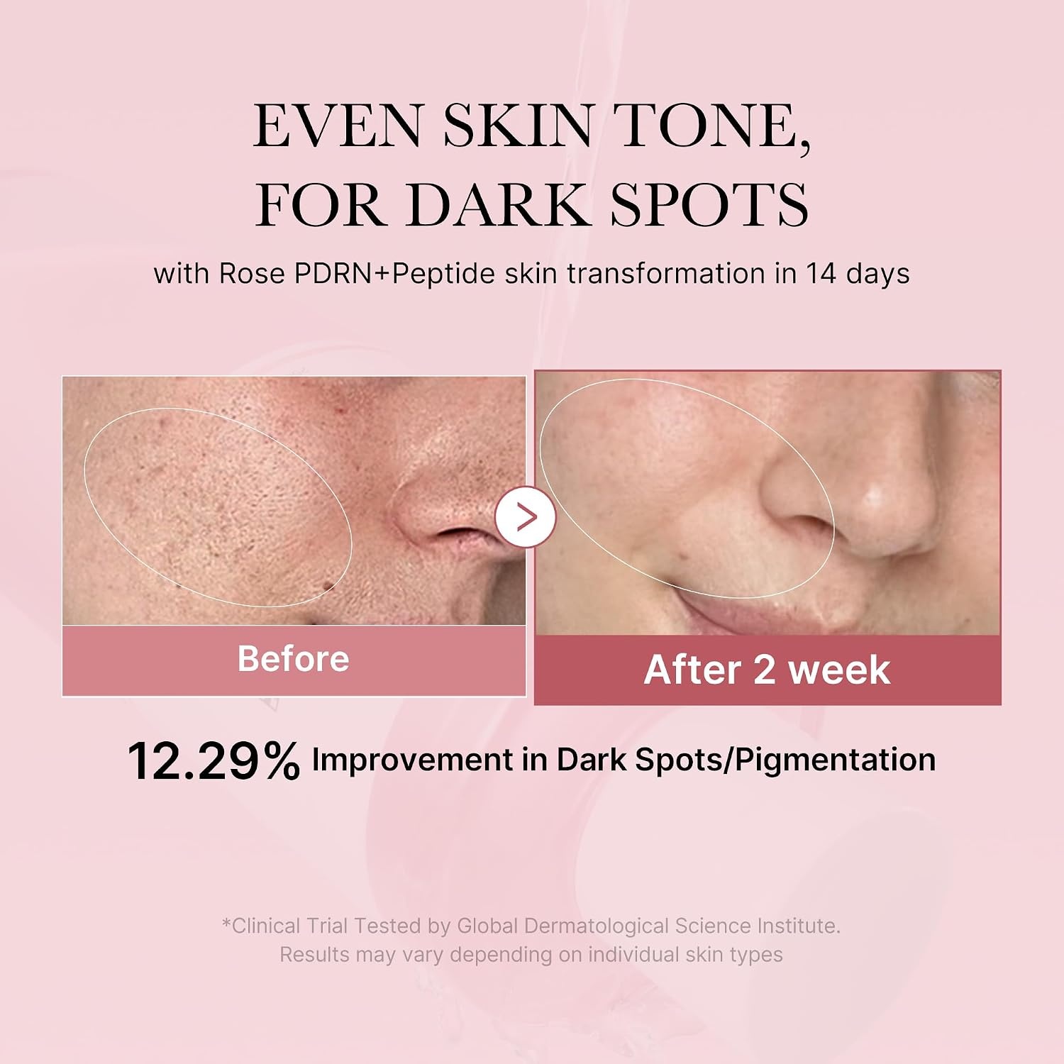 image:imagemedicube PDRN Toner Salmon DNA Milky Toner for Hydrating Moisturizing Soothing with Ceramide Peptide Glass Glow Skin Korean Skincare 507 floz Pack of 3Rose PDRN Watery