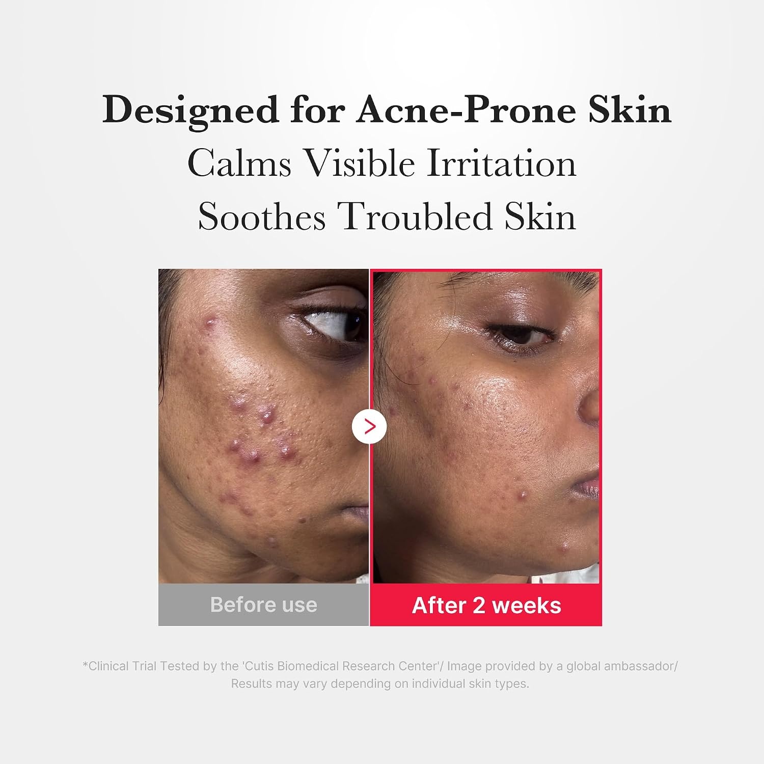 image:imagemedicube Red Power Duo for Soothing HOCI Soothing Spray amp TXA Serum