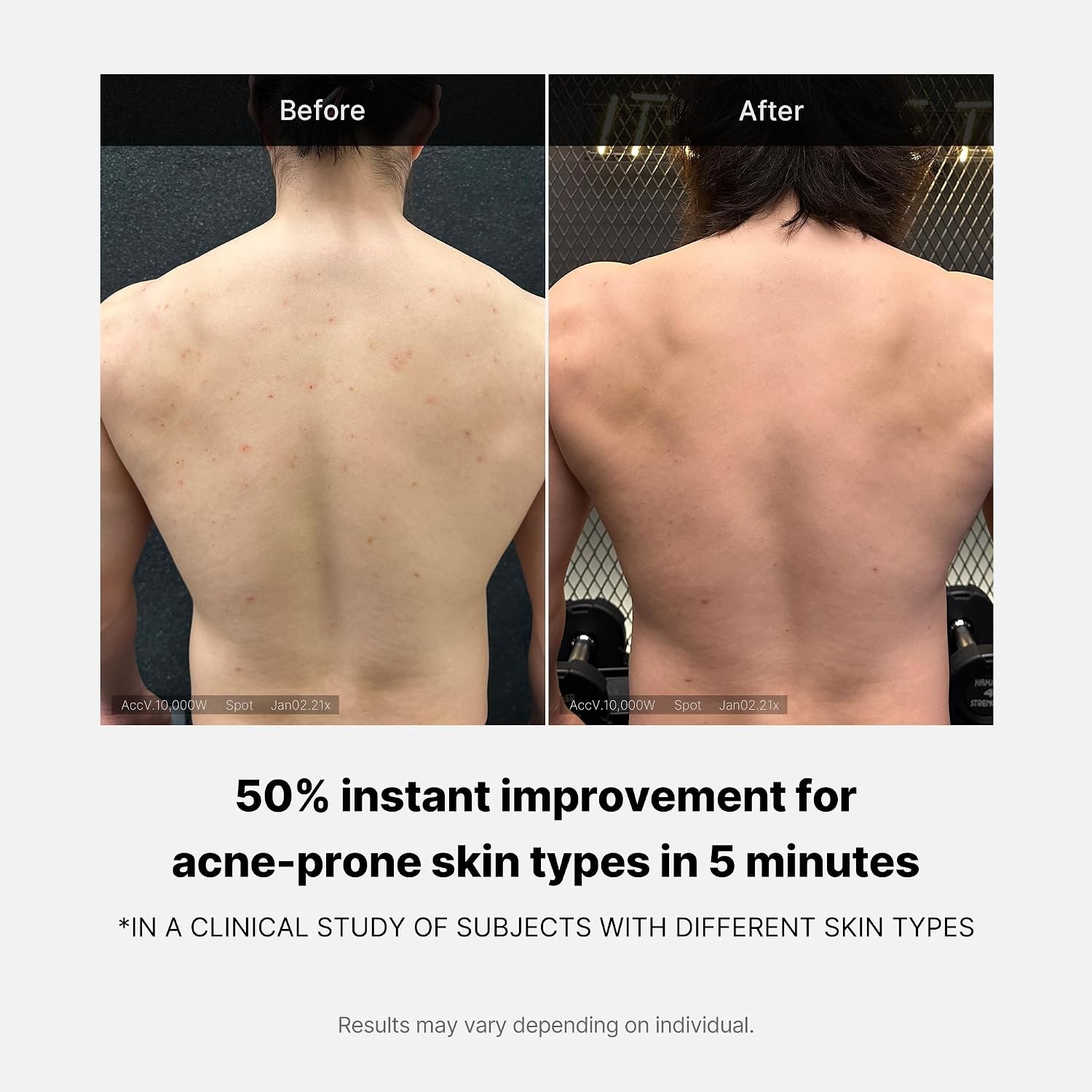image:imagemedicube Clarifying Back amp Chest Duo Red Body Wash amp Soft Peeling Sponge